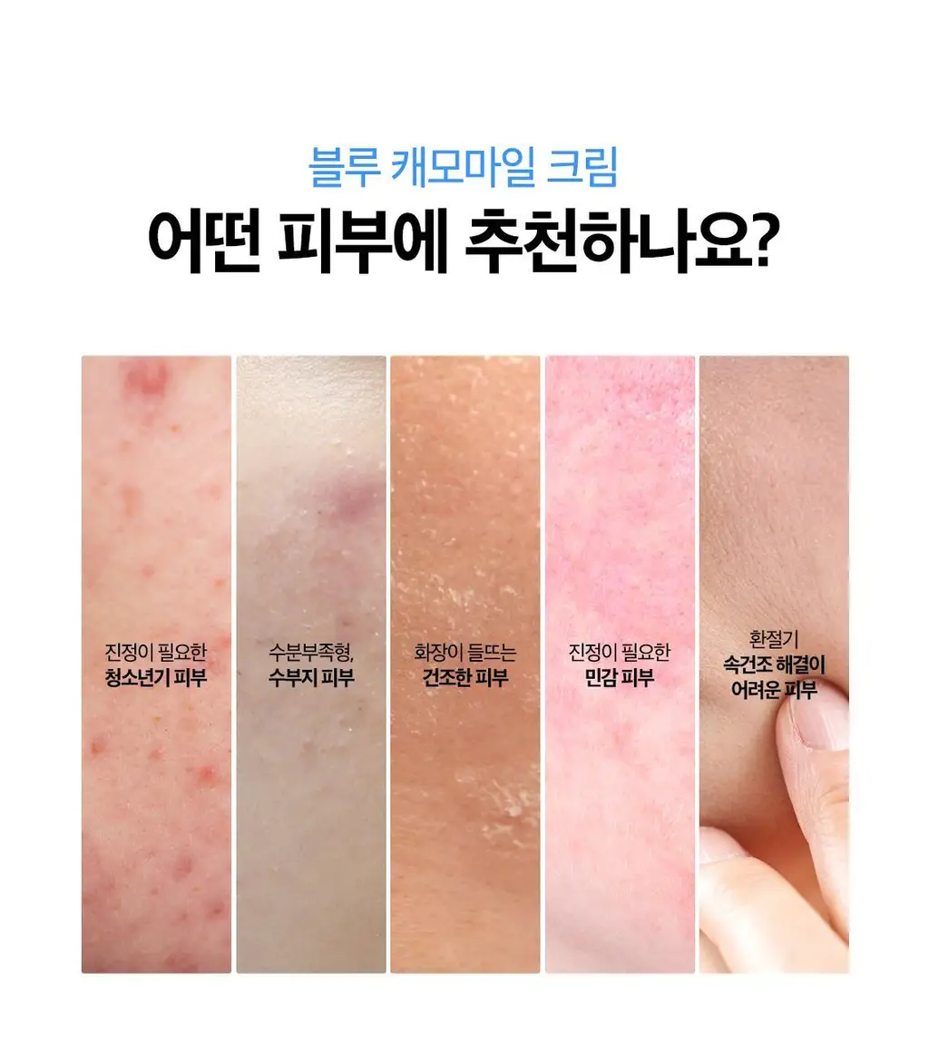 [쫀득물착크림] 스킨푸드 블루 캐모마일 히알루로닉 수분크림 기획(70ml+30ml) 상세페이지 27